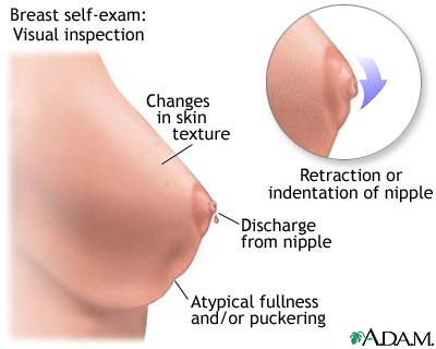 Breast Self-exam